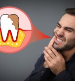 Gum Disease